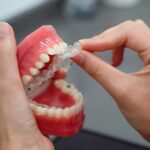 Zahn-Fehlstellungen lassen sich in den meisten Fällen inzwischen auf eine einfache und effektive Art und Weise korrigieren. Bildquelle: ©  Beyza Kaplan / Unsplash.com